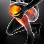 s-rodilla