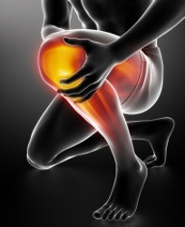 s-rodilla